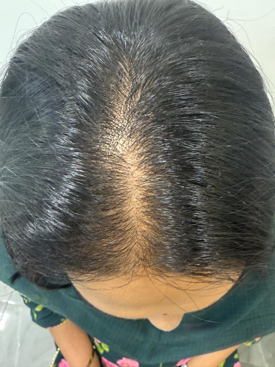 Before Treatment