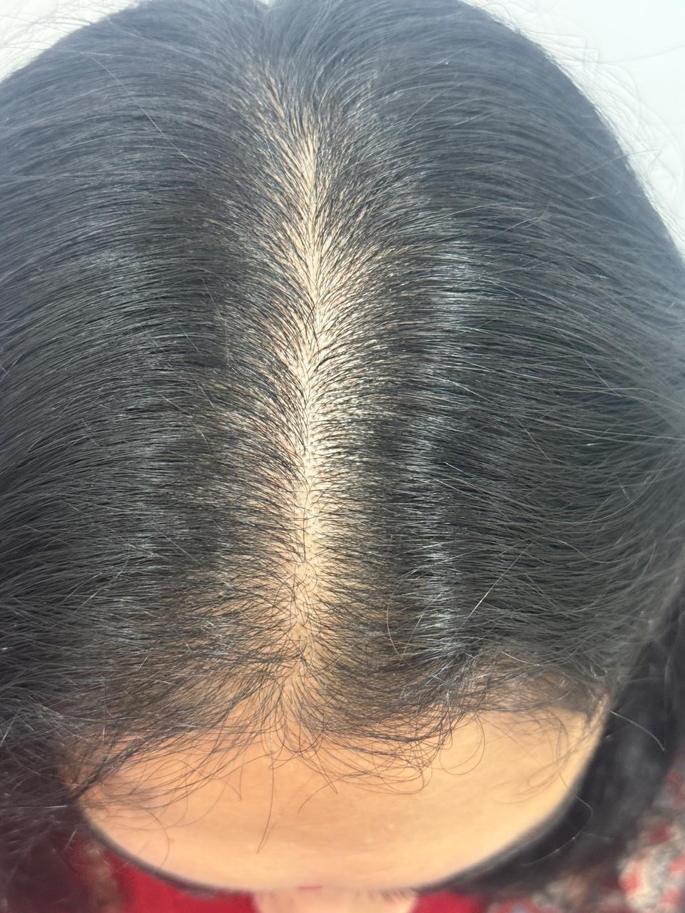 After Treatment